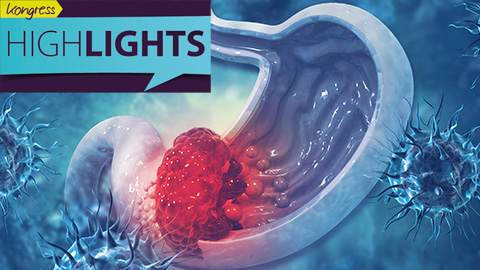 Grafische Darstellung eines Magens mit Tumor, umgeben von Immunzellen Grafische Darstellung eines Magens mit Tumor, umgeben von Immunzellen