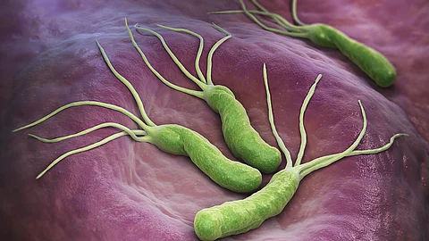 Helicobacter pylori Helicobacter pylori