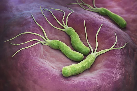 Helicobacter pylori