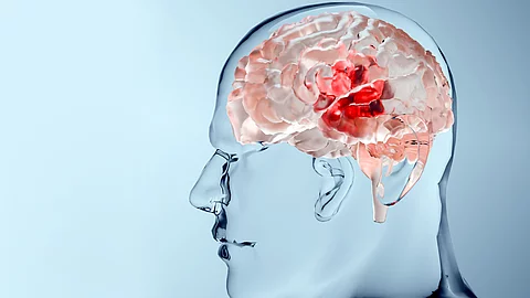 Hirnmetastasen zeigen auffällige Kombinationen genetischer Veränderungen