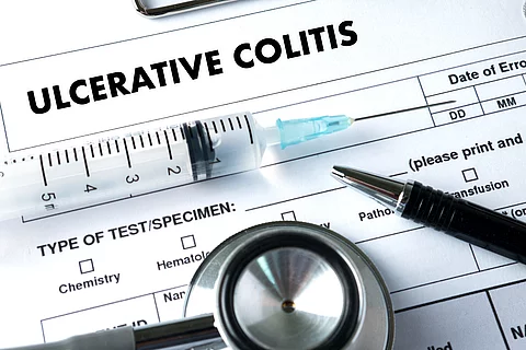 ULCERATIVE COLITIS Healthcare modern medical Doctor concept