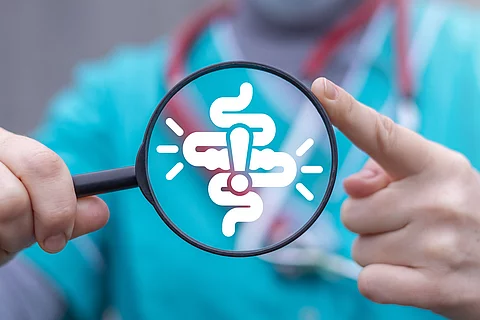 Achtung: gestörte Stoffwechselprozesse in Darm und Mikrobiom bei CED.