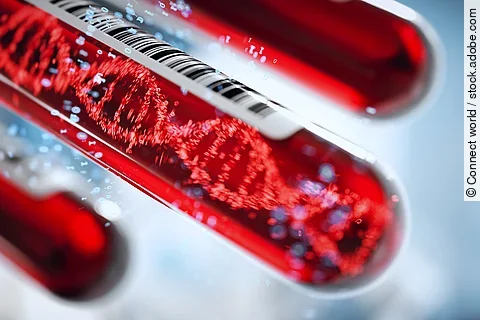 Bluttest für Pankreaskarzinom-Screening rückt in Reichweite