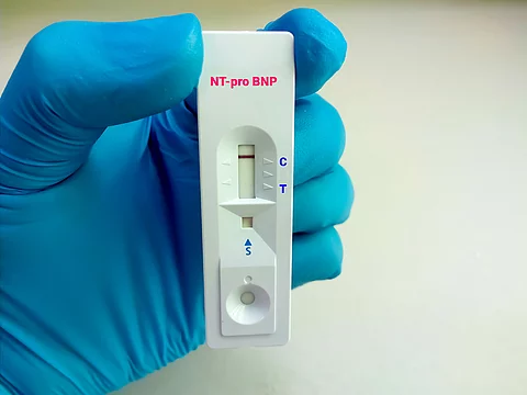 Kardiale Biomerker - auch als Frühwarnsystem für Krebserkrankungen?