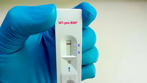 Kardiale Biomerker - auch als Frühwarnsystem für Krebserkrankungen? Kardiale Biomerker - auch als Frühwarnsystem für Krebserkrankungen?