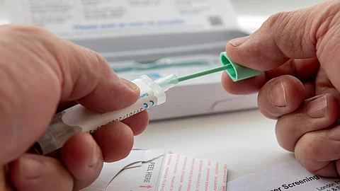 FIT-Stuhltest zum Darmkrebsscreening