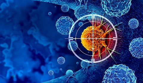 BRAF-V600E-mutiertes kolorektrales Karzinom: Erste zielgerichtete, biomarkerbasierte Kombinationsthrapie in der Erstlinie