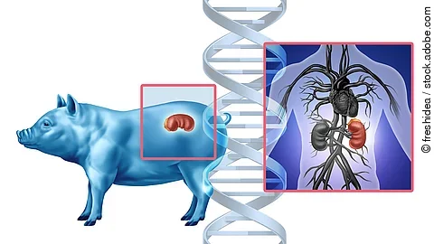 Pig Kidney Transplant concept as a genetically modified animal organ transferred to humans as Xenotransplantation technology or Xenogeneic transplantation as bioengineered DNA. Pig Kidney Transplant concept as a genetically modified animal organ transferred to humans as Xenotransplantation technology or Xenogeneic transplantation as bioengineered DNA.