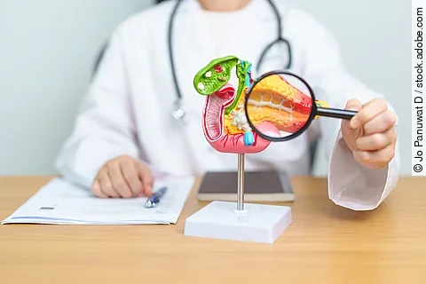 Pankreaskarzinom: Antibiotika verdoppeln Überlebenszeit bei Bauchspeicheldrüsenkrebs