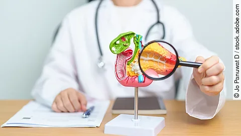 Pankreaskarzinom: Antibiotika verdoppeln Überlebenszeit bei Bauchspeicheldrüsenkrebs Pankreaskarzinom: Antibiotika verdoppeln Überlebenszeit bei Bauchspeicheldrüsenkrebs