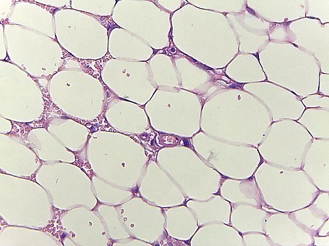 Viszerales Fettgewebe - eine Gefahr für Blutgefäße