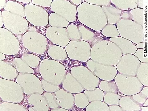 Viszerales Fettgewebe - eine Gefahr für Blutgefäße