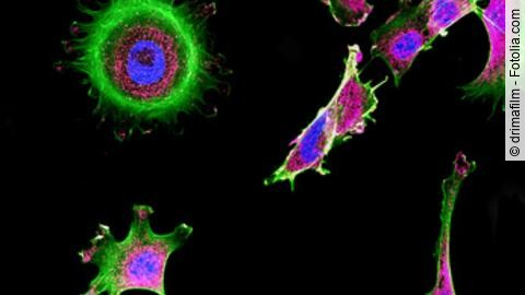 Fluoreszierende Tumorzellen