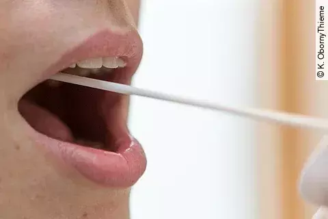 Speichelprobe