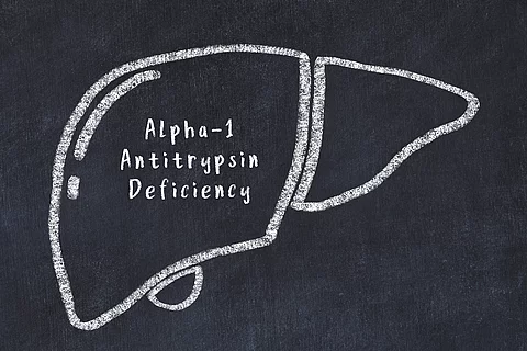 Welche Patienten mit Alpha-1-Antitrypsin-Mangel entwickeln eine Leberfibrose und welche nicht?