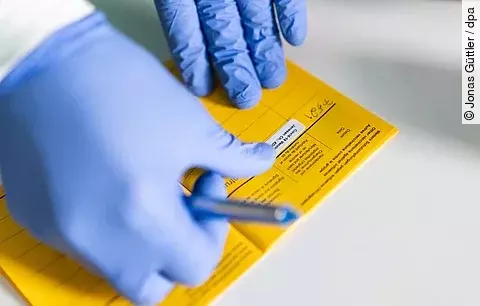 Impfpass: STIKO empfiehlt Hepatitis-B-Impfung bereits im Kindesalter