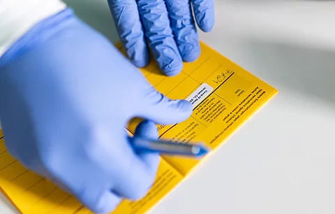 Impfpass: STIKO empfiehlt Hepatitis-B-Impfung bereits im Kindesalter