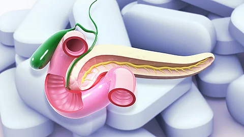 stilisierte, anatomische Darstellung der Bauchspeicheldrüse mit angrenzenden Strukturen (u. a. Gallengang) vor einem Hintergrund aus Tabletten