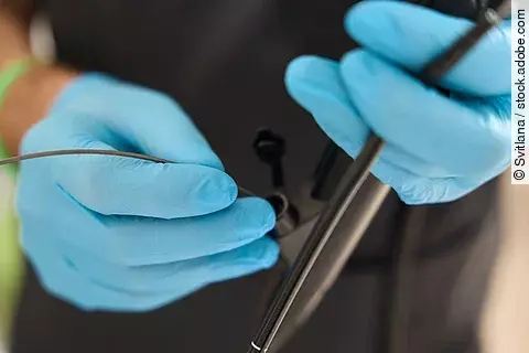 EUS macht’s möglich: Leberbiopsie, Bildgebung und Druckmessung in einem einzigen Eingriff