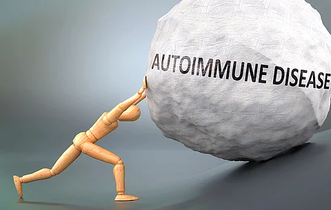 Autoimmunerkrankung - symbolhaft dargestellt als hölzerne Figur, die ein schweres Gewicht schieben muss
