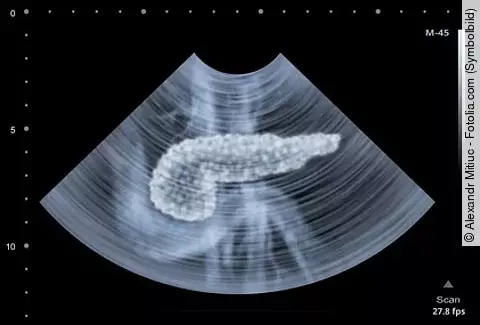 Pankreas im Ultraschall