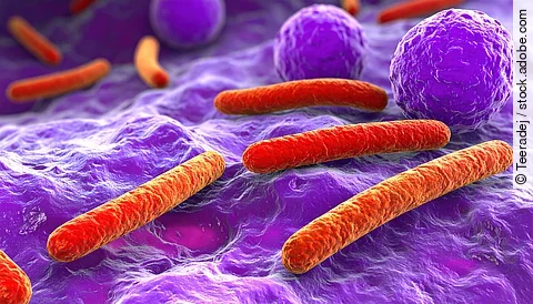 Mikroskopische Aufnahme von Fusobakterien assoziiert mit Krebszellen im Darm