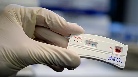 Europa verfehlt Teilziele im Kampf gegen HIV und Hepatitis