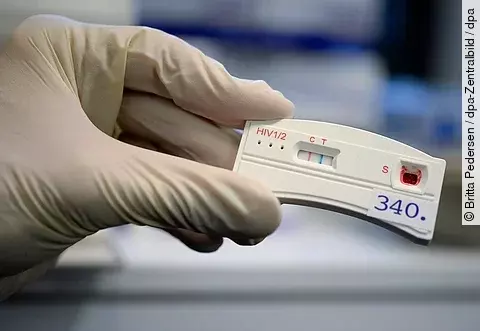 Europa verfehlt Teilziele im Kampf gegen HIV und Hepatitis