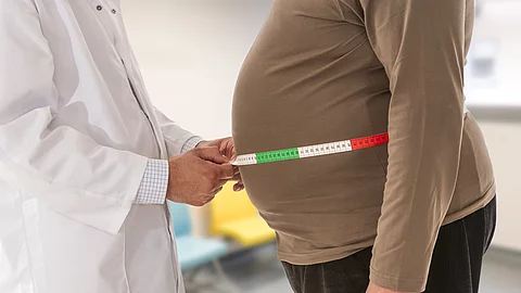 Doctor measuring obese man waist body fat. Obesity and weight loss.