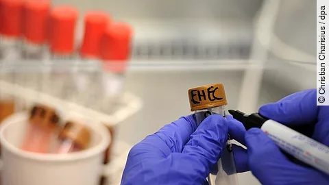 Eine Medizinisch-Technische Assistentin arbeitet unter einer Abzugshaube im Universitätsklinikum Hamburg-Eppendorf (UKE) an Stuhlproben, die auf EHEC-Bakterienstämme untersucht werden.