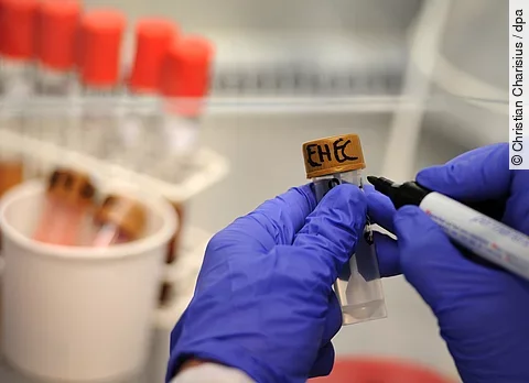 Eine Medizinisch-Technische Assistentin arbeitet unter einer Abzugshaube im Universitätsklinikum Hamburg-Eppendorf (UKE) an Stuhlproben, die auf EHEC-Bakterienstämme untersucht werden.