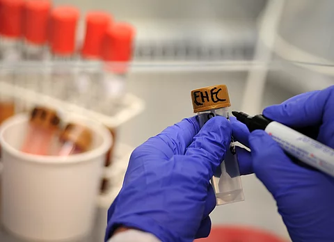 Eine Medizinisch-Technische Assistentin arbeitet unter einer Abzugshaube im Universitätsklinikum Hamburg-Eppendorf (UKE) an Stuhlproben, die auf EHEC-Bakterienstämme untersucht werden.