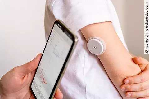 CGM-System - Fraglicher Nutzen bei Stoffwechelgesundeh