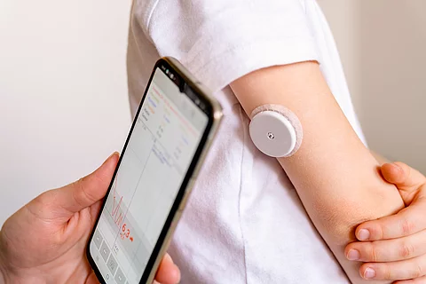 CGM-System - Fraglicher Nutzen bei Stoffwechelgesundeh