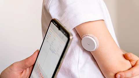 CGM-System - Fraglicher Nutzen bei Stoffwechelgesundeh